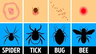 How to Identify a Bug Bite and What to Do With It