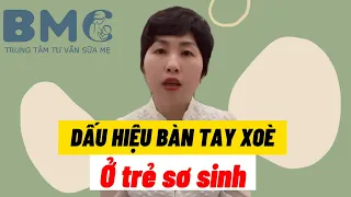 Dấu Hiệu Bàn Tay Xòe Ở Trẻ Sơ Sinh | HỎI ĐÁP CHO BÉ BÚ MẸ | Bác Sĩ Sữa Mẹ Anh Thy