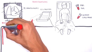 Acute Coronary Syndrome DETAILED Overview (MI, STEMI, NSTEMI)