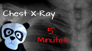 MASTER Chest X-ray in ONLY 5 Minutes.