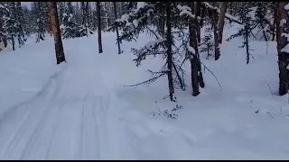 Установка на мочеточки капкан сокольцев.