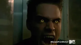 Top 7 Liam Dunbar Roars (TeenWolf)