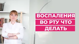 Воспаления во рту. Почему бывает. Что делать.