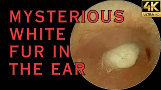 MYSTERIOUS WHITE FUR IN THE EAR (4K 60FPS)