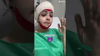 Minha Feminização facial 💉