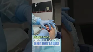 Удаление зубов на время. Имплантация зубов.