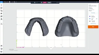 Envision One RP & Exocad Integration