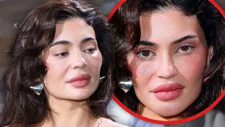 Celebrities With Permanently Botched Plastic Surgery