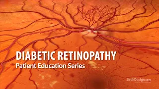 Diabetic Retinopathy