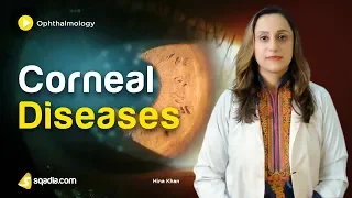 Corneal Diseases | Ophthalmology Online Lecture | Medical Student V-Learning | sqadia.com