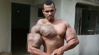 Bodybuilder nearly dies after bicep injections
