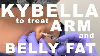 Kybella for Arm and Belly Fat - Dr. Paul Ruff | West End Plastic Surgery