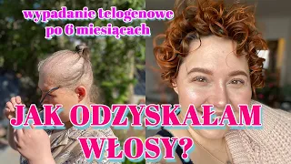 JAK ODZYSKAŁAM WŁOSY? KROK PO KROKU CO ROBIĆ? Wypadanie/łysienie telogenowe UPDATE po 6 miesiącach