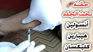 حقنه تحت الجلد للمبتدأين(أنسولين_هيبارين_كلكسان)Subcutaneous injection