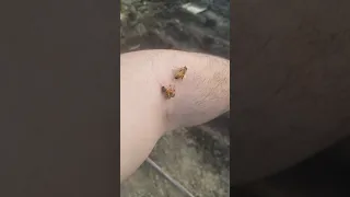 eres alergico@ a la picadura de abeja? mira este video