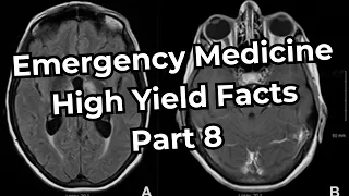 Emergency Medicine Board Exam High Yield Facts (Part 8)