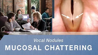 Vocal Cord Nodules - What Do They Sound Like? | Mucosal Chattering