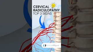 Cervical Radiculopathy Top 3 Signs #physiotherapy #physicaltherapy