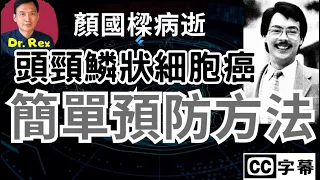 顏國樑病逝; 究竟什麼是鱗狀細胞癌？ 醫生教你兩招簡單預防方法 Head and Neck Squamous Cell Carcinoma and how to prevent it