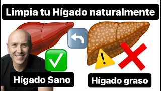 ¿CÓMO CURAR EL HÍGADO GRASO SIN MEDICAMENTOS? - Dr. Carlos Jaramillo