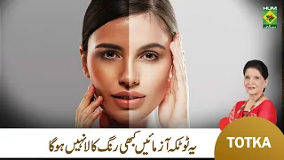 Zubaida Apa Totkay | Beauty Tips for Sun Burn Skin | Sunburn Causes & Treatment | MasalaTv