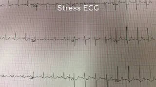 Resting ECG vs. Stress ECG