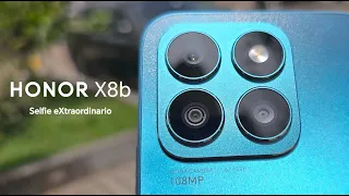 HONOR X8b: ¿Vale la pena? 📽️