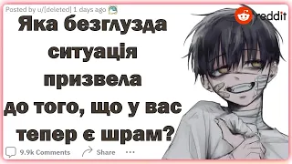 Яка безглузда ситуація призвела до того, що у вас тепер є шрам? | Реддіт українською