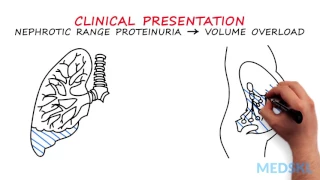 Nephrology – Proteinuria: By Manish Suneja M.D.