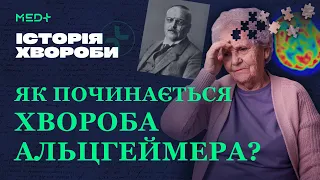 Порушення пам'яті (не) хвороба Альцгеймера? Ранні ознаки деменції. Історія хвороби