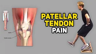 3 Exercises for Jumper’s Knee (Patellar Tendinopathy)