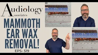 MAMMOTH EAR WAX REMOVAL - EP519