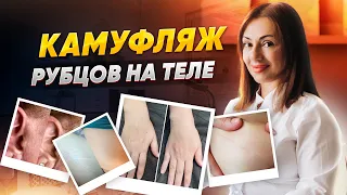 Камуфляж рубцов на теле. Разбор видов и целевой аудитории