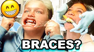 LUKE Gets BRACES?! *Will He GAG!?*