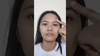 SIMPLE EXERCISES FOR BELL'S PALSY