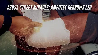 Azusa Street Miracle: Amputee Regrows Leg!