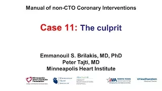 Case 11: PCI Manual - The "culprit"