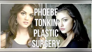 Phoebe Tonkin Plastic Surgery
