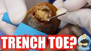 EVER SEEN A ROTTEN TOENAIL BEFORE? ***DO NOT TURN ON SMELL-O-VISION***