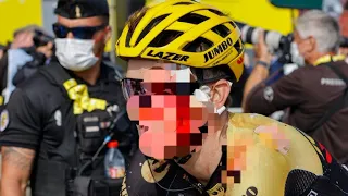 Sepp Kuss blooded and bandaged after crash but finishes Tour de France stage 20