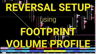 How I Find Setups To Trade | Overextended Downtrend Reversal Using Footprint & Volume Profile