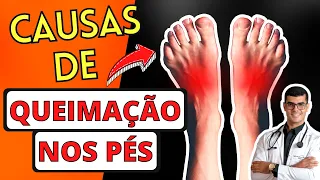 9 Causas de QUEIMAÇÃO NOS PÉS (FORMIGAMENTO e DOR nos Pés)