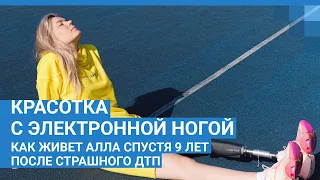 Красотка с электронной ногой. Как живет Алла спустя 9 лет после страшного ДТП| NGS.RU