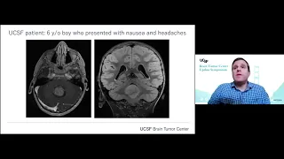 Brain Tumor Genomics/Epigenomics - David A. Solomon, MD, PhD