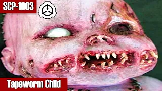 SCP-1003 Tapeworm Child - Humanity's Worst Nightmare: Cannibal Tapeworm Breeds Children