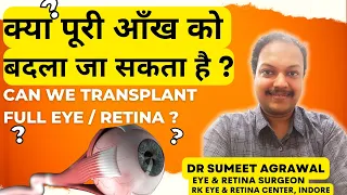 क्या पूरी आँख को बदला जा सकता है ? Is whole eye / retina transplant possible ?