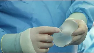 Placing the breast implant Motiva under the chest muscle. Breast augmentation
