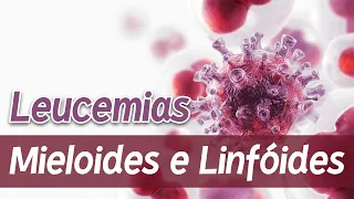 Leucemias Mieloides e Linfóides (LMA, LLA, LMC, LLC) │ Patologia e Fisiopatologia