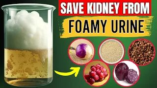 Top 17 SuperFoods to stop Proteinuria quickly and Heal Kidney Fast (Not What You Think)