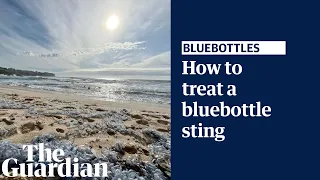What to do if you get stung by a bluebottle, explained by a lifesaver